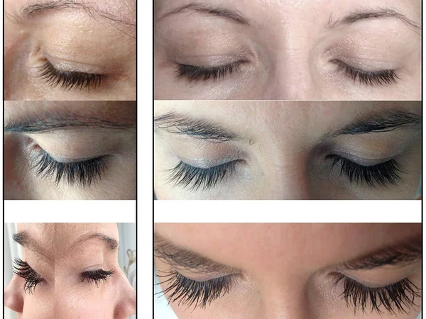 M2Lashes Eyelash Activating Serum 5ml & M2Beaute Gift Box, Most Powerful Eyelash Growth Serum, Based on The Proven and Eff